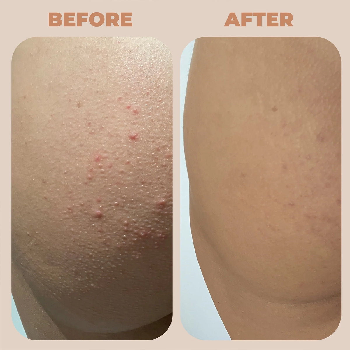 Bum + Body Cream 3.4oz S68147